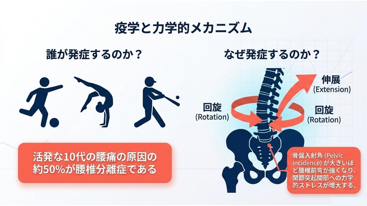腰椎分離症の疫学と力学的メカニズム。サッカー・体操・野球など伸展と回旋を繰り返す競技に多く、活動的な10代の腰痛の約半数を占める。腰椎の伸展と左右の回旋が組み合わさると関節突起間部に応力が集中し、骨盤入射角が大きいほど腰椎前弯が強まって負荷が増大する